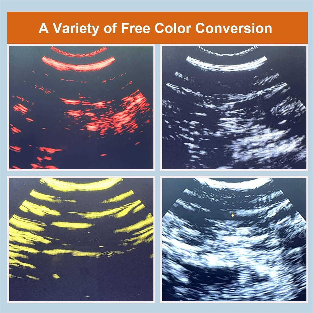 Wireless Portable Veterinary Ultrasound Scanner B4268